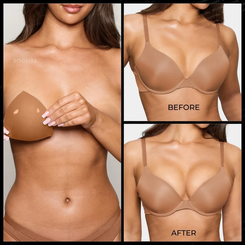 Invisible Lift Inserts® - Image 23